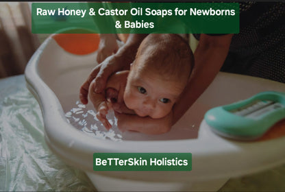 Tender Skin NEW Baby Newborn Soaps -Handmade organic wildcrafted Gentle Chemical Synthetic Detergent Sls free soap•Raw Honey & Castor Oil Baby Shower Gift Baskets